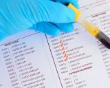 Rękawiczka w niebieskiej rękawiczce trzyma probówkę z krwią nad listą badań, w tym ESTRADIOL, FSH, LH, PROGESTERON, TESTOSTERON, co może pomóc w zrozumieniu, jak podnieść poziom estrogenu.