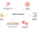 Mio-inozytol: kiedy brać? Wspiera owulację, reguluje cykl, poprawia transport glukozy, lipidogram, zmniejsza HOMA-IR i rozwój oocytów.